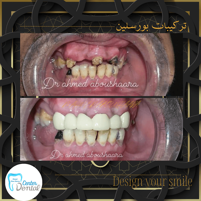مركز الدكتور احمد ابو شعرة لزراعة و تجميل الاسنان
