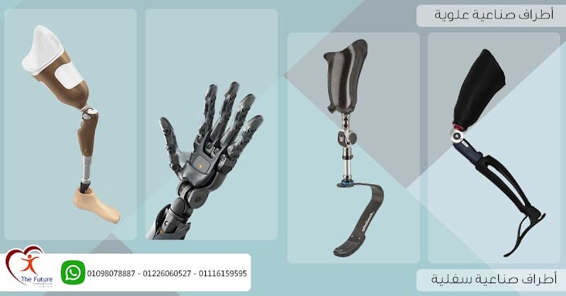 The future of prosthetics